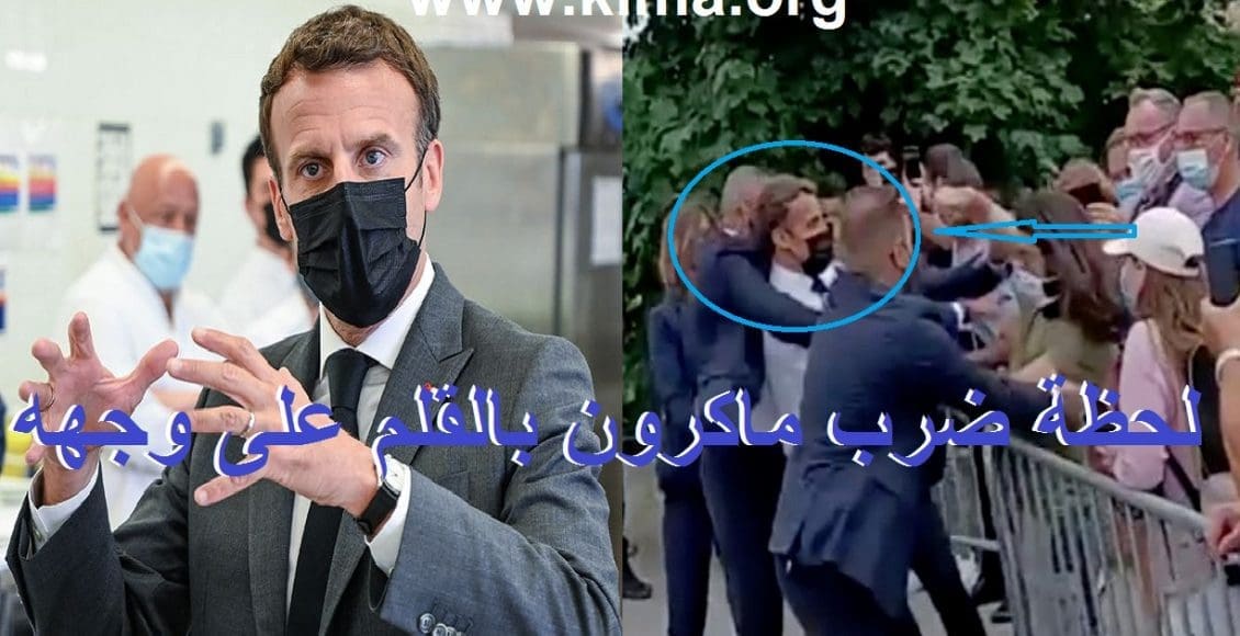 ضرب ماكرون صفعة قوية بالقلم على وجهه